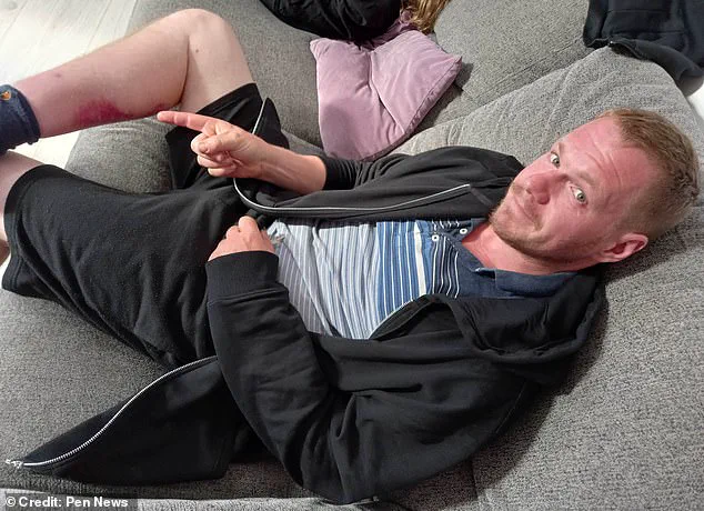 Noble False Widow Spider Bite Leaves Window Cleaner in Agony, Forced to Miss Work and Hospitalized