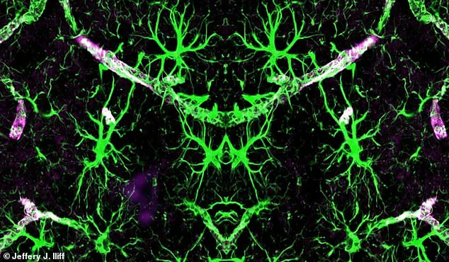 Sleep Position and Memory Loss: What Experts Reveal About Cognitive Health Risks