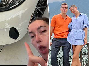 TikTok Influencer Sparks Outrage Over Viral Video Shared While Suffering From Contagious Pink Eye