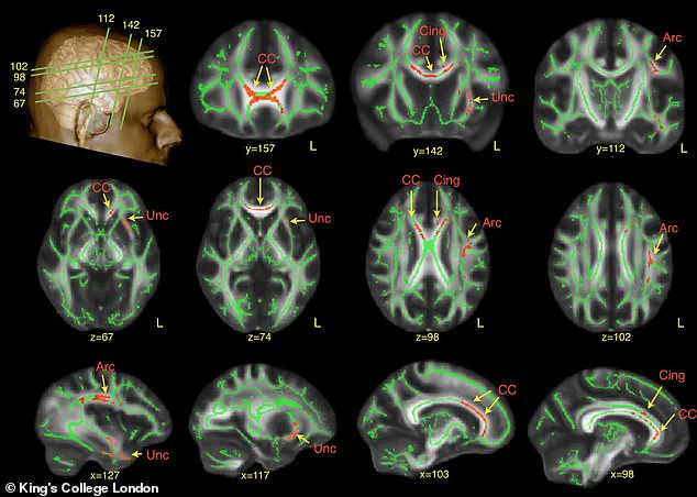 Groundbreaking Study Suggests Dogs May Exhibit Neurodivergent Traits Similar to Autism and ADHD, According to Dr. Jacqueline Boyd of Nottingham Trent University