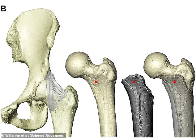 Pivotal Shift in Human Evolution: Scientists Identify Earliest Known Species to Walk Upright