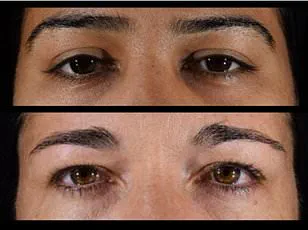 New Study Challenges Longevity Benefits of Plant-Based Diets, Sparks Debate on Public Health Advisories