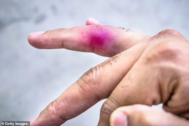 Alberta's Legal Community Shaken by Rare Child Lawsuit Over Daycare Play Injury