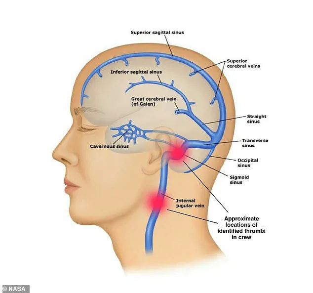 ISS Medical Evacuation Sparks Debate on Space Regulations and Public Safety