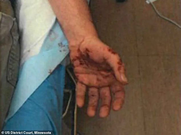 ICE Agent Testifies in Court About Harrowing Encounter That Left Him with 33 Stitches and Lingering Fear