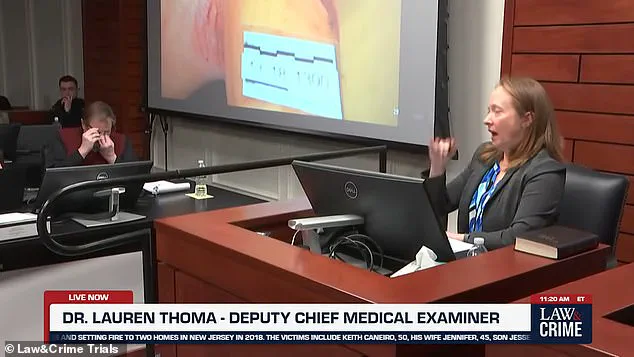 Emotional Courtroom Moment as Medical Examiner Details Brutal Injuries in Nephew's Murder Trial