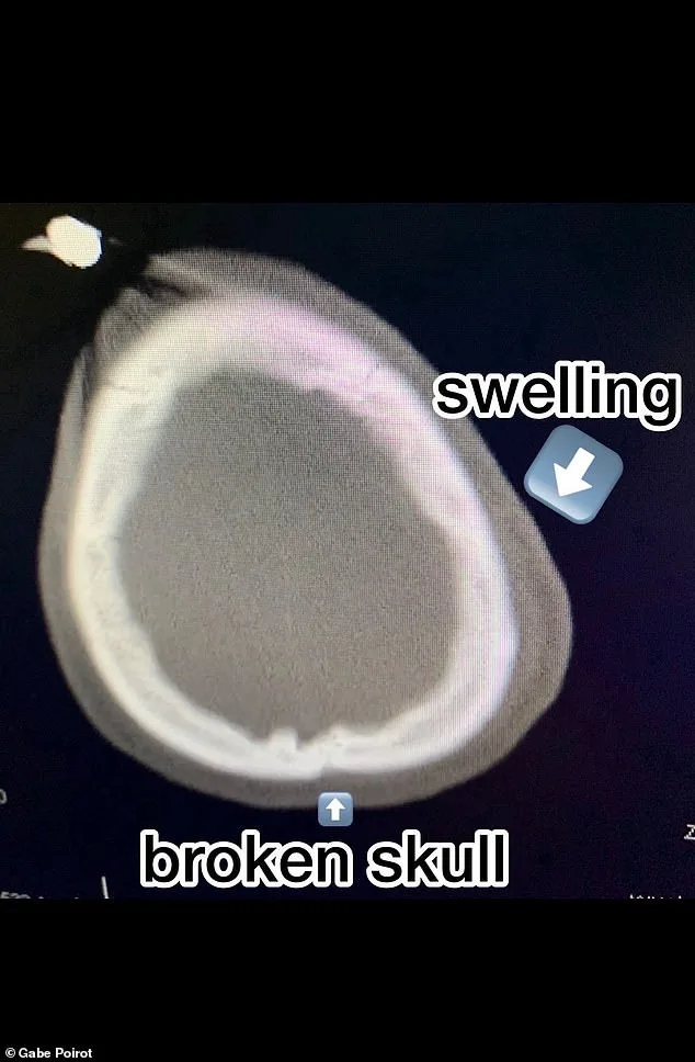 Gabe Poirot's 18-Day Coma and Claim of Meeting Jesus After Severe Skateboard Accident