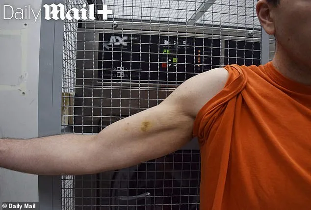 Brutal Case Reveals Deformities; Victims Fight Back.