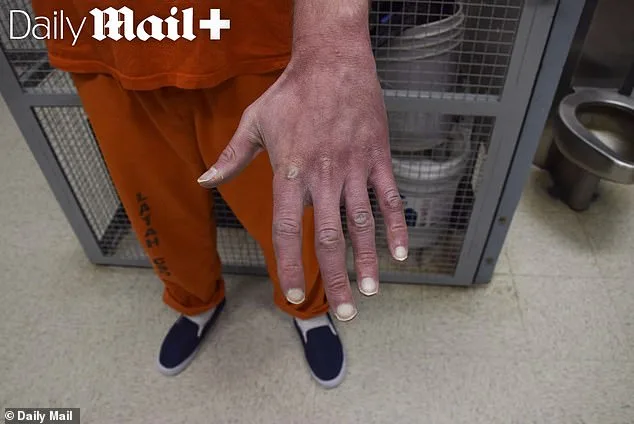 Brutal Case Reveals Deformities; Victims Fight Back.