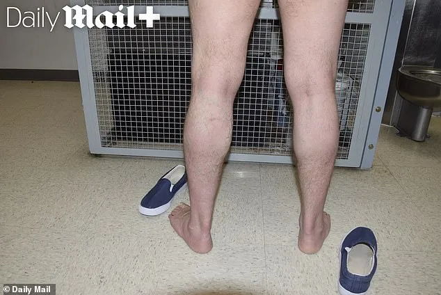 Brutal Case Reveals Deformities; Victims Fight Back.