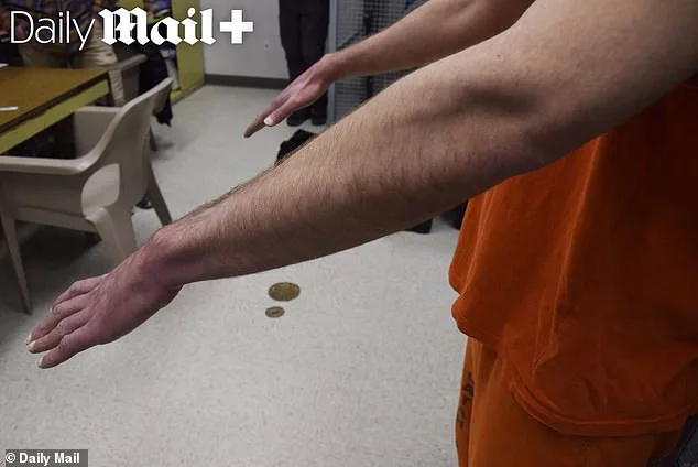 Brutal Case Reveals Deformities; Victims Fight Back.