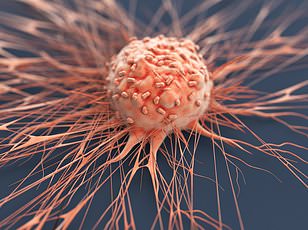 Woman's Mystery Tongue Ulcers Diagnosed as Rare Oral Cancer