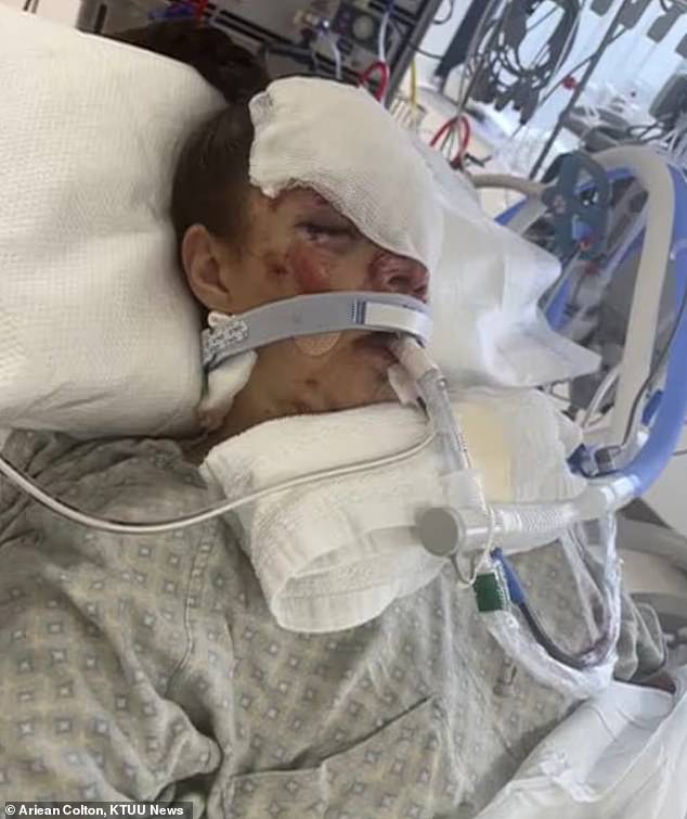 Kenai mother reveals severe injuries one year after bear attack