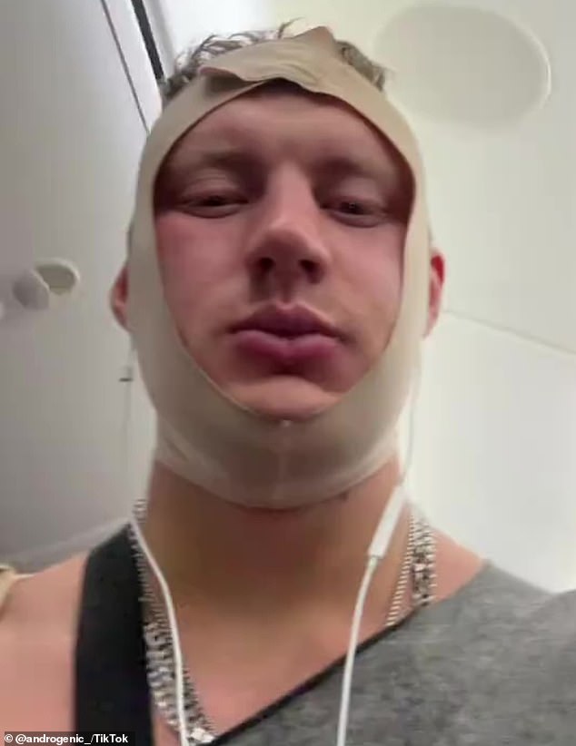 Jetstar removes Brisbane influencer for appearing unfit after recent cosmetic surgery.