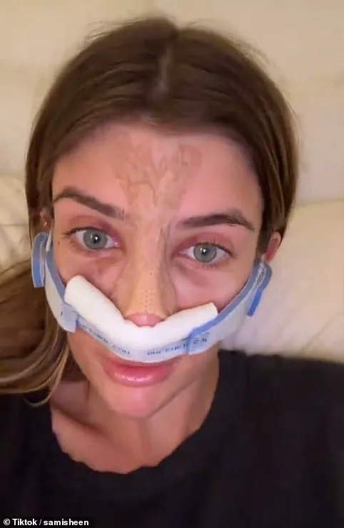 Teen Uses OnlyFans Earnings to Afford Plastic Surgery and Boost Self-Esteem