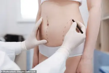 Rise in Plastic Surgery Popularity Sparks Safety Concerns