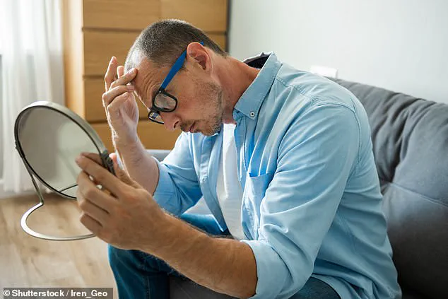 Scientists Unveil Protein Key to Preventing Male Baldness