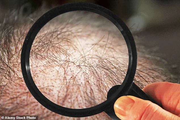 Japanese Researchers Discover Plant Extracts That Promote Hair Growth and Are Readily Available Worldwide