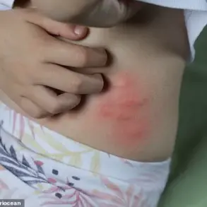 Experts Warn of Flea 'Explosion' as Warm Weather Puts Even Pet-Free Homes at Risk