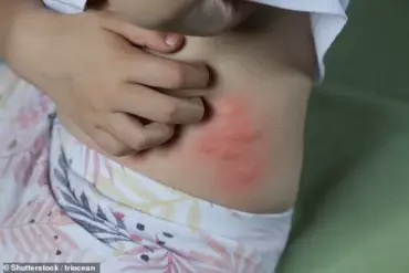 Experts Warn of Flea 'Explosion' as Warm Weather Puts Even Pet-Free Homes at Risk