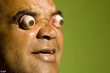 Texas A&M Professor Debunks Myth: Sneezing with Eyes Open Won't Pop Them Out